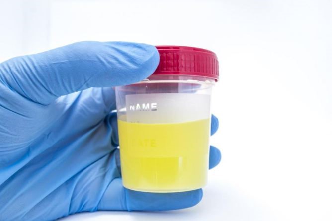 X Synthetic Urine Omaha NE 68181